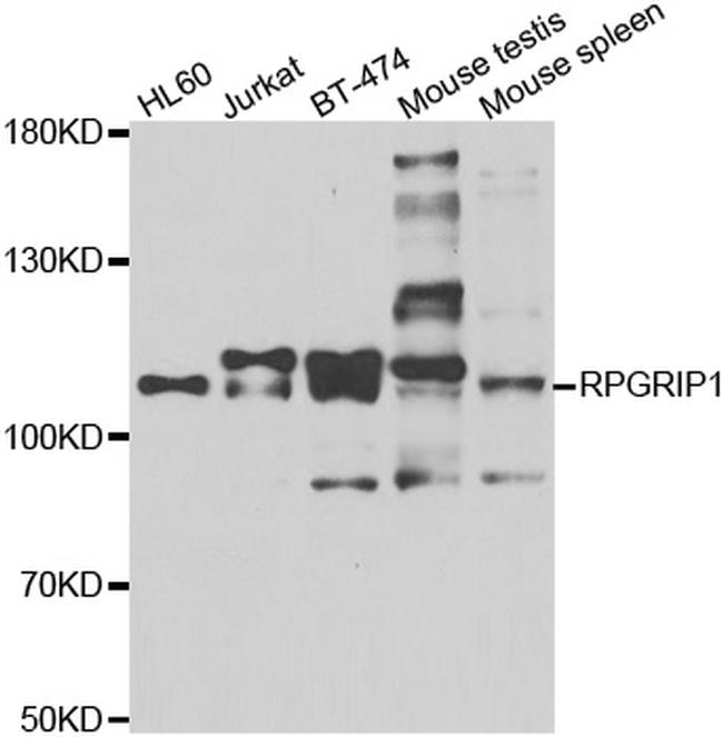 RPGRIP1 Antibody in Western Blot (WB)