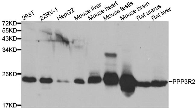 PPP3R2 Antibody in Western Blot (WB)