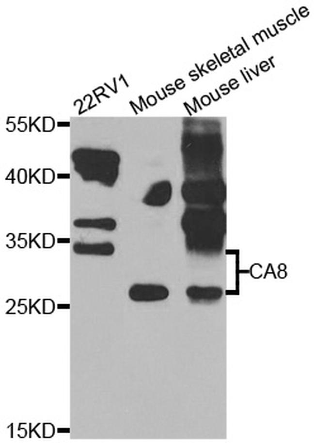 Carbonic Anhydrase VIII Antibody in Western Blot (WB)