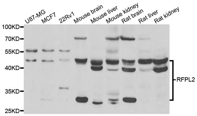 RFPL2 Antibody in Western Blot (WB)