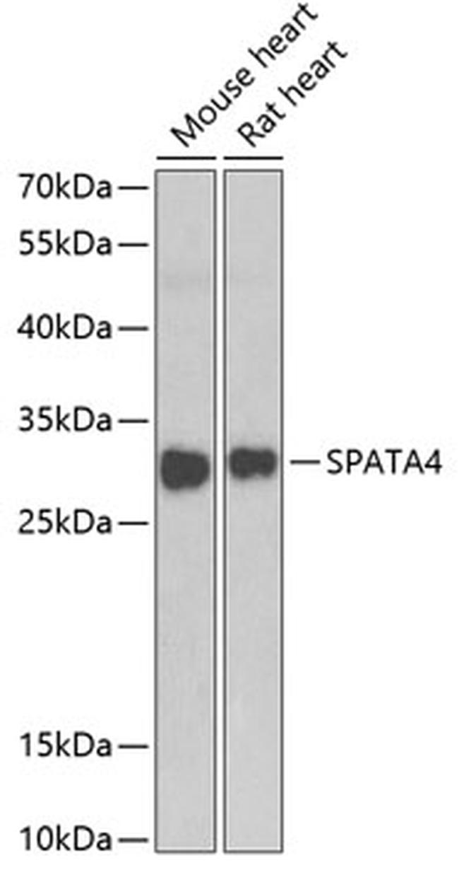 SPATA4 Antibody in Western Blot (WB)