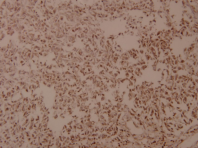 COL5A3 Antibody in Immunohistochemistry (Paraffin) (IHC (P))