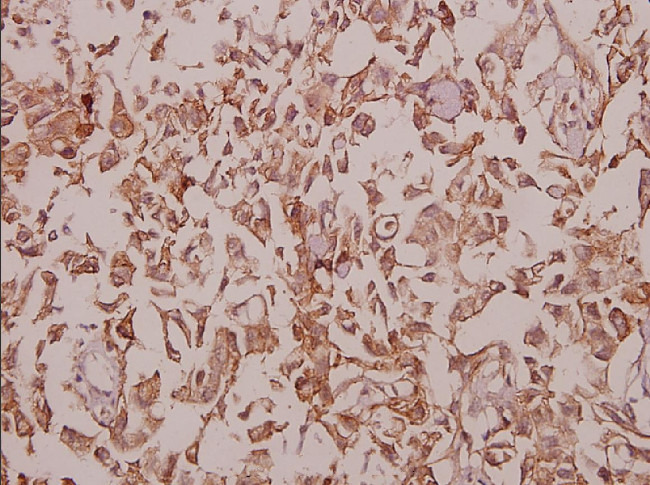 KCNMB2 Antibody in Immunohistochemistry (Paraffin) (IHC (P))