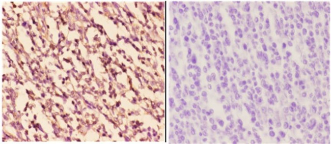 WIPF1 Antibody in Immunohistochemistry (Paraffin) (IHC (P))
