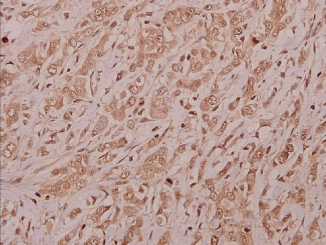 TAIP12 Antibody in Immunohistochemistry (Paraffin) (IHC (P))