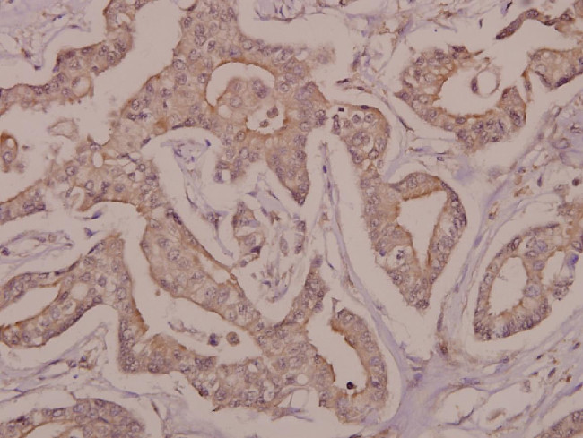 DRAK2 Antibody in Immunohistochemistry (Paraffin) (IHC (P))