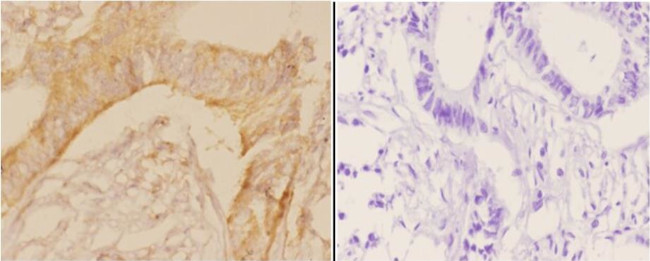 POTEKP Antibody in Immunohistochemistry (Paraffin) (IHC (P))