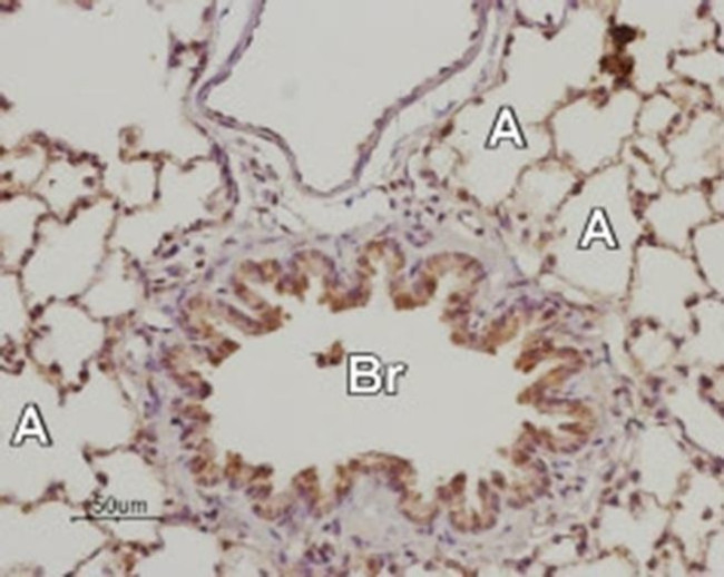 ADORA2B (extracellular) Antibody in Immunohistochemistry (Paraffin) (IHC (P))