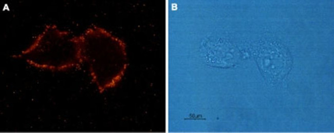 AGTR1 (extracellular) Antibody in Immunocytochemistry (ICC/IF)
