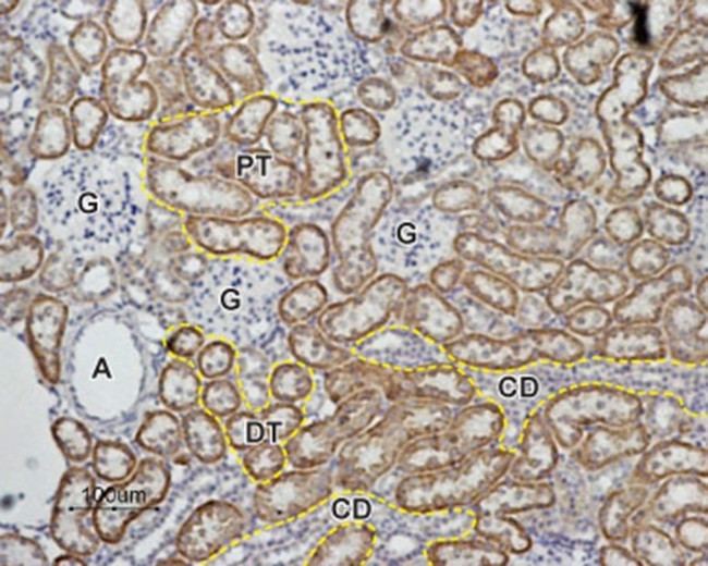 MAS1 Antibody in Immunohistochemistry (Paraffin) (IHC (P))