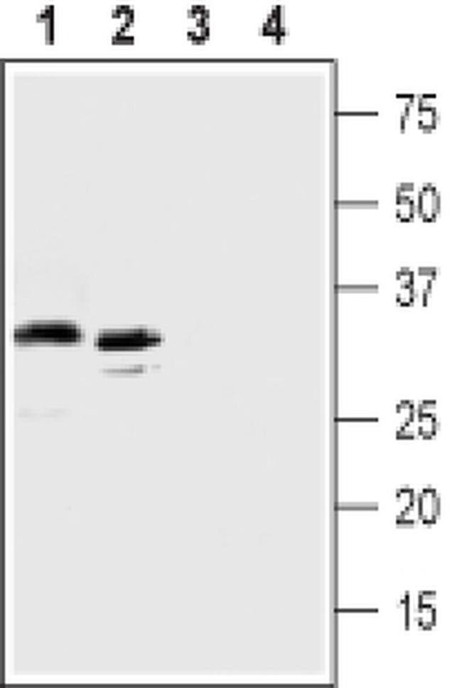 GPR77 (extracellular) Antibody in Western Blot (WB)
