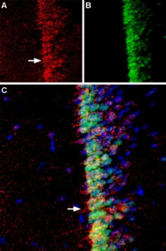 Adenylate Cyclase 3 (extracellular) Antibody in Immunohistochemistry (IHC)