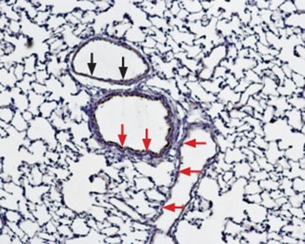 Bestrophin 1 (extracellular) Antibody in Immunohistochemistry (Paraffin) (IHC (P))