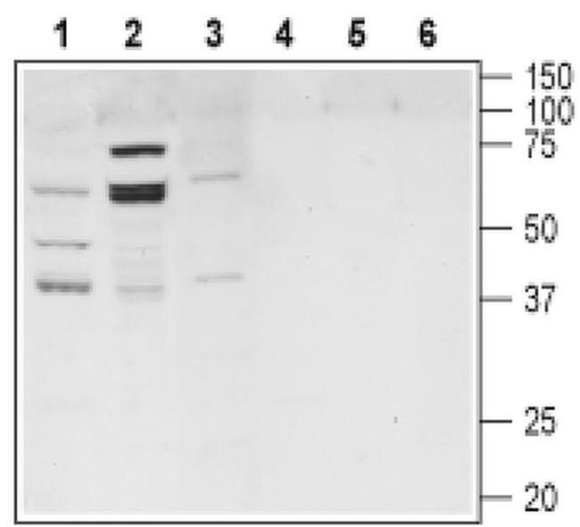 TGR5 Antibody in Western Blot (WB)