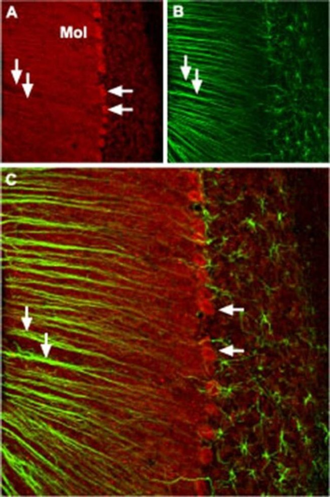 CaV2.1 Antibody in Immunohistochemistry (IHC)