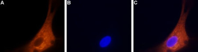 CACNA1B Antibody in Immunocytochemistry (ICC/IF)