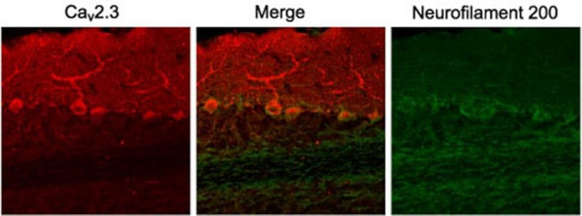 CaV2.3 Antibody in Immunohistochemistry (IHC)
