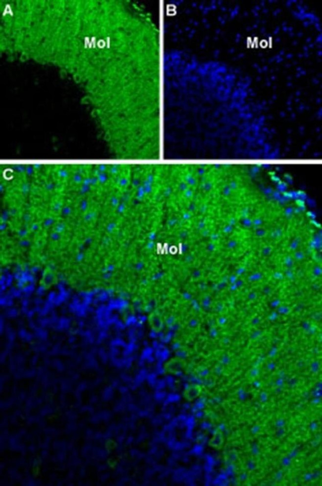 CaV3.1 Antibody in Immunohistochemistry (IHC)
