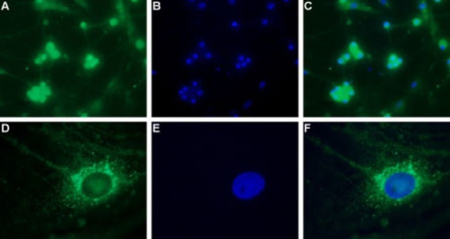 CaV3.2 Antibody in Immunocytochemistry (ICC/IF)