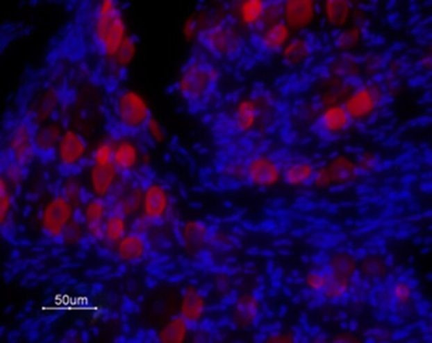 TRPV1 (extracellular) Antibody in Immunohistochemistry (Frozen) (IHC (F))