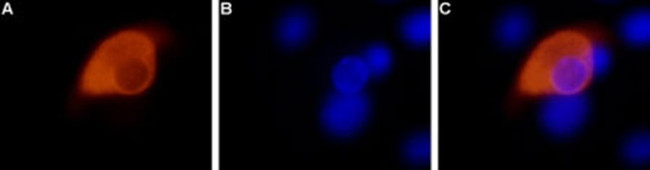 TRPV1 Antibody in Immunocytochemistry (ICC/IF)