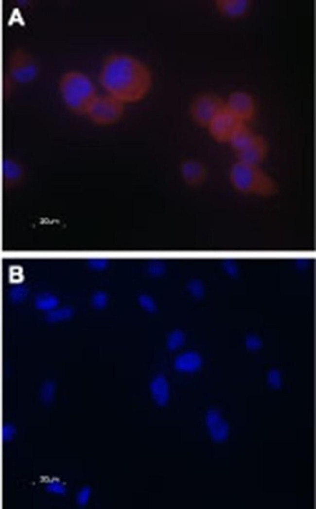 TRPV5 Antibody in Immunocytochemistry (ICC/IF)