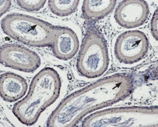 TRPM5 Antibody in Immunohistochemistry (Paraffin) (IHC (P))