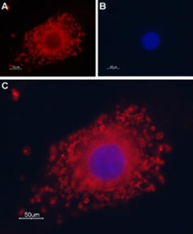 PKD2 Antibody in Immunocytochemistry (ICC/IF)