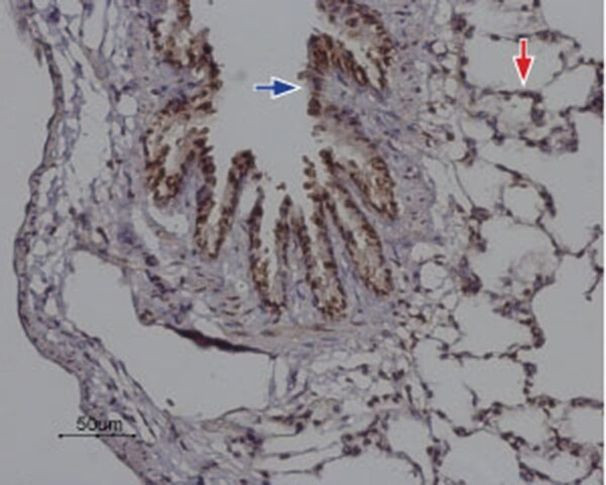 ORAI2 Antibody in Immunohistochemistry (Paraffin) (IHC (P))