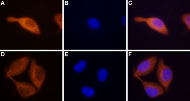 STIM2 Antibody in Immunocytochemistry (ICC/IF)