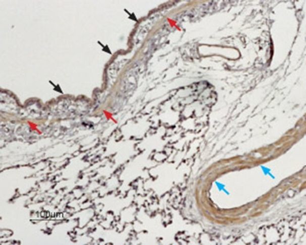 TPCN1 (extracellular) Antibody in Immunohistochemistry (Paraffin) (IHC (P))