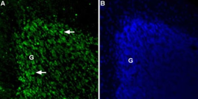 TPCN2 (extracellular) Antibody in Immunohistochemistry (IHC)