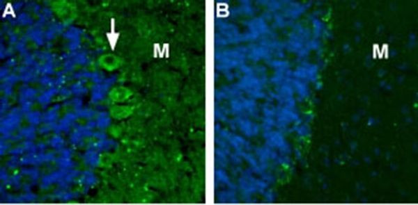 CACNA2D2 (extracellular) Antibody in Immunohistochemistry (IHC)