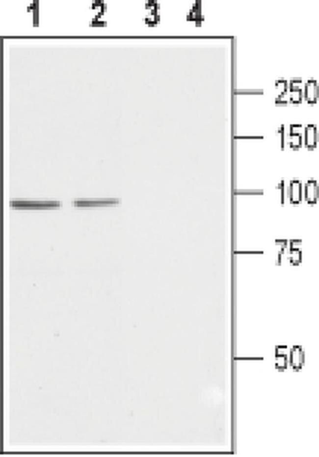 CACNB2 Antibody in Western Blot (WB)