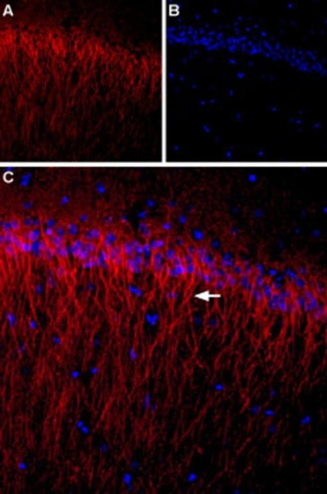 CACNB1 Antibody in Immunohistochemistry (IHC)