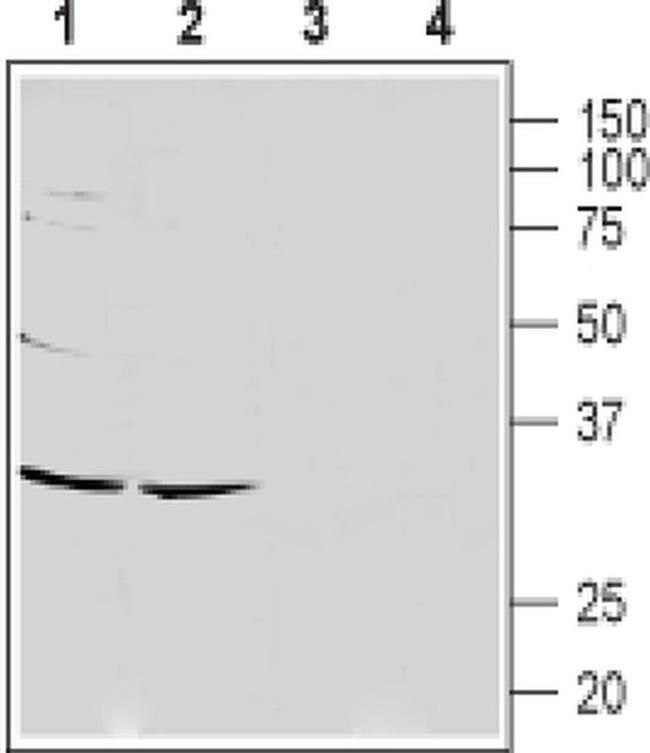 CACNG7 (extracellular) Antibody in Western Blot (WB)