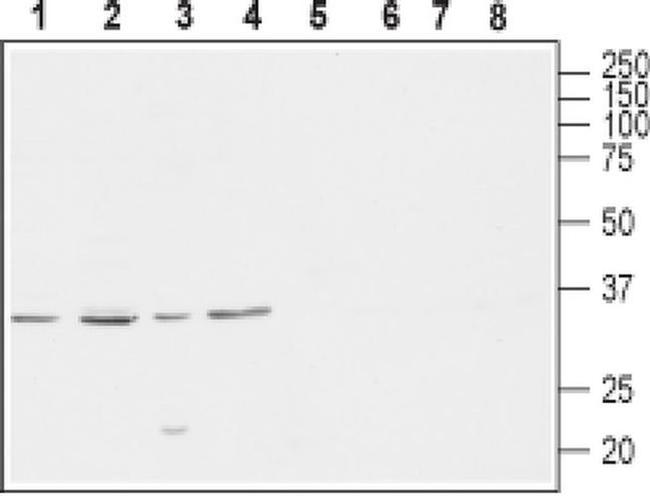CACNG4 Antibody in Western Blot (WB)