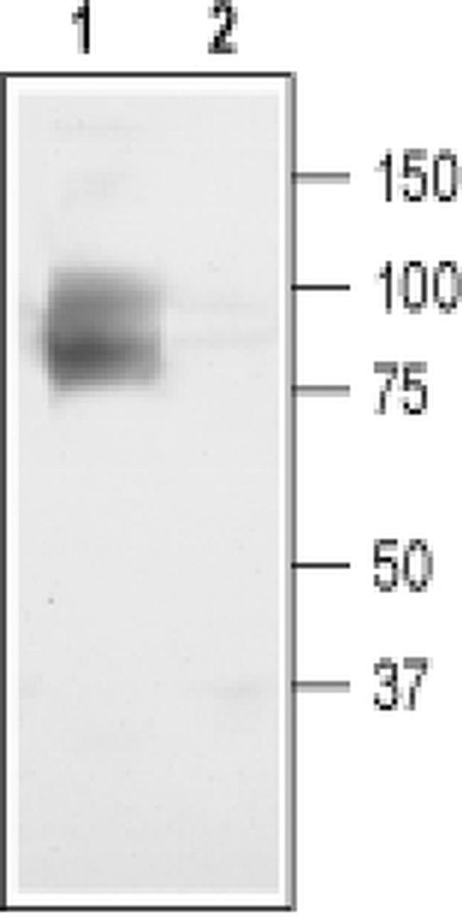 CLCN3 Antibody in Western Blot (WB)