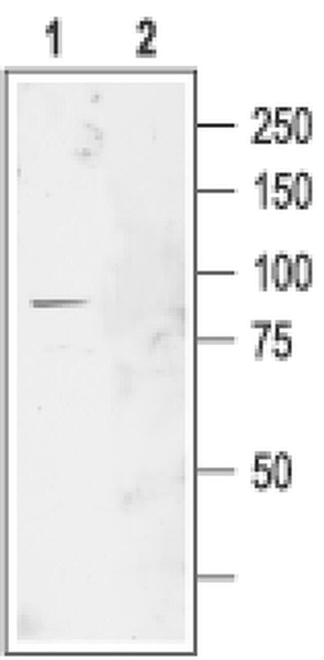 CLCN2 Antibody in Western Blot (WB)