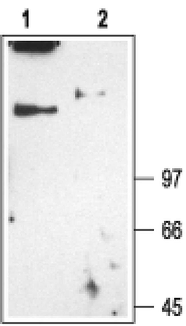 CLCN1 Antibody in Western Blot (WB)