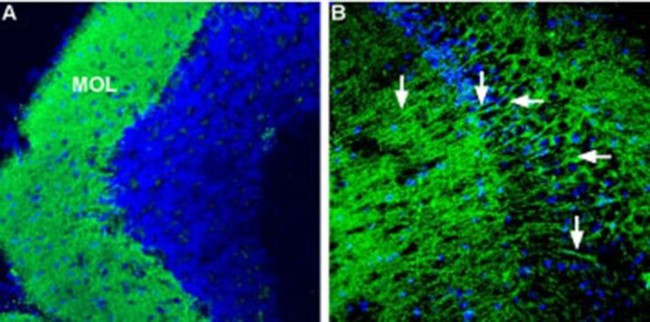 CRHR1 (extracellular) Antibody in Immunohistochemistry (IHC)