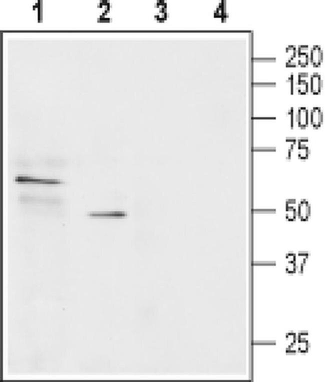 SLC22A1 Antibody in Western Blot (WB)