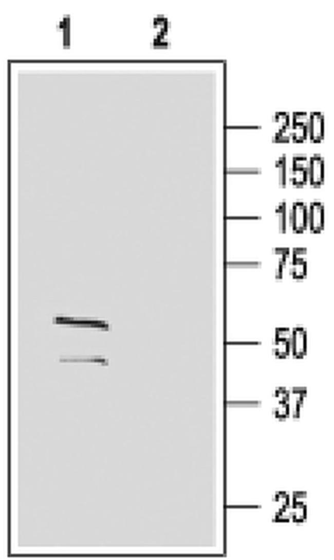 GABRG2 (extracellular) Antibody in Western Blot (WB)