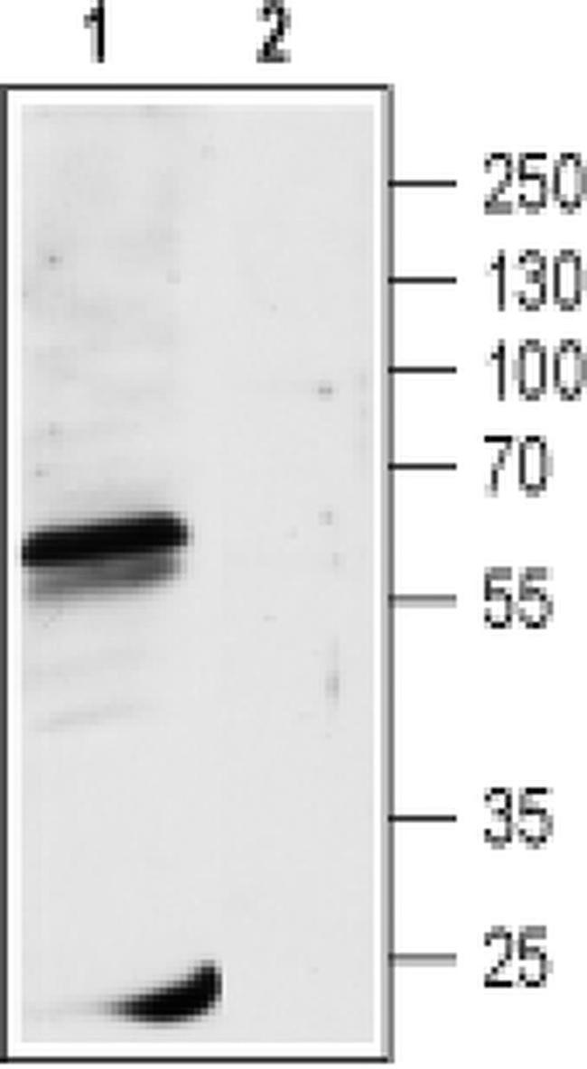 GABRR1 (extracellular) Antibody in Western Blot (WB)