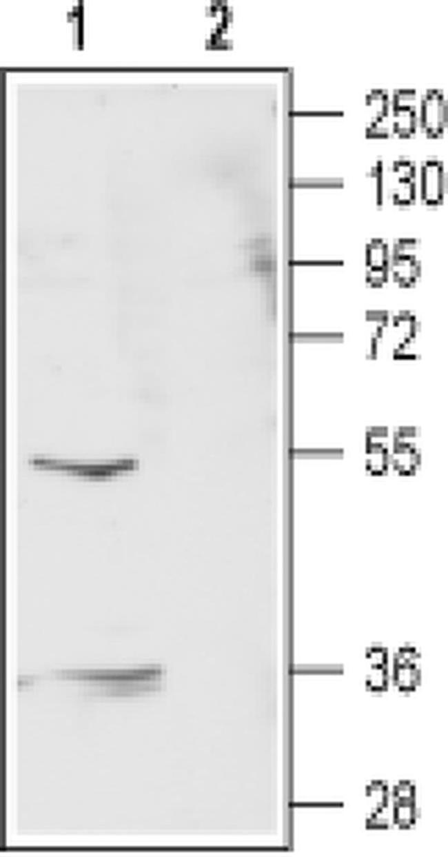GABRR2 (extracellular) Antibody in Western Blot (WB)