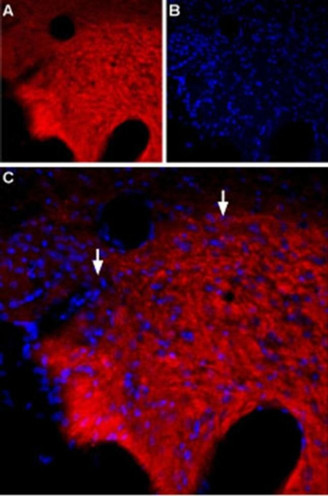 GABRQ (extracellular) Antibody in Immunohistochemistry (IHC)