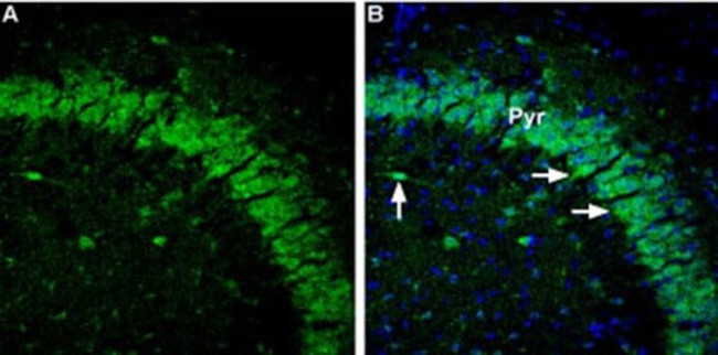 GABRA5 Antibody in Immunohistochemistry (IHC)