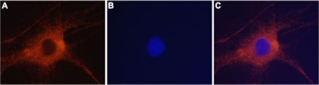 GluR6 Antibody in Immunocytochemistry (ICC/IF)