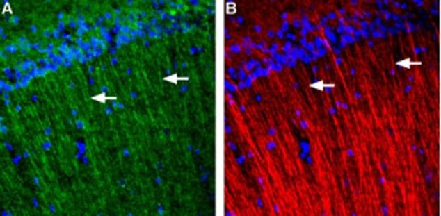 GALR3 (extracellular) Antibody in Immunohistochemistry (IHC)