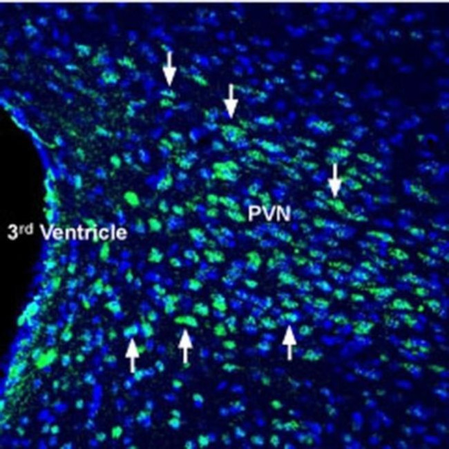 Glucagon Receptor (extracellular) Antibody in Immunohistochemistry (Frozen) (IHC (F))